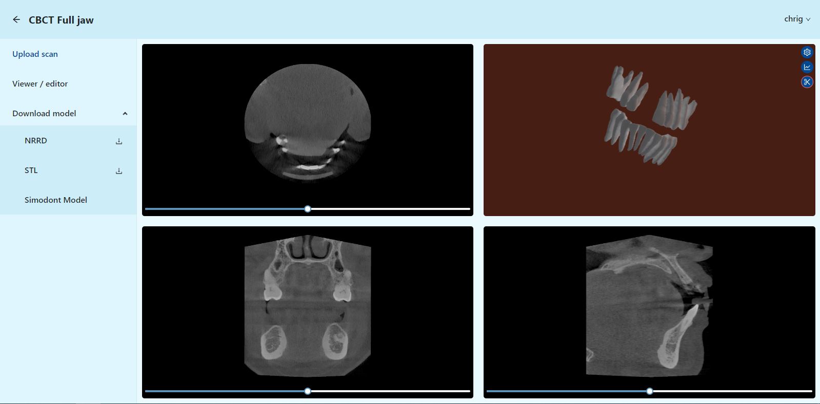 Neural network development helps dentofacial surgeons to diagnose