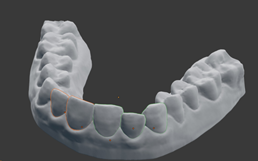 3D снимок челюсти
